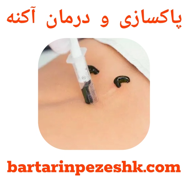 پاکسازی و درمان آکنه