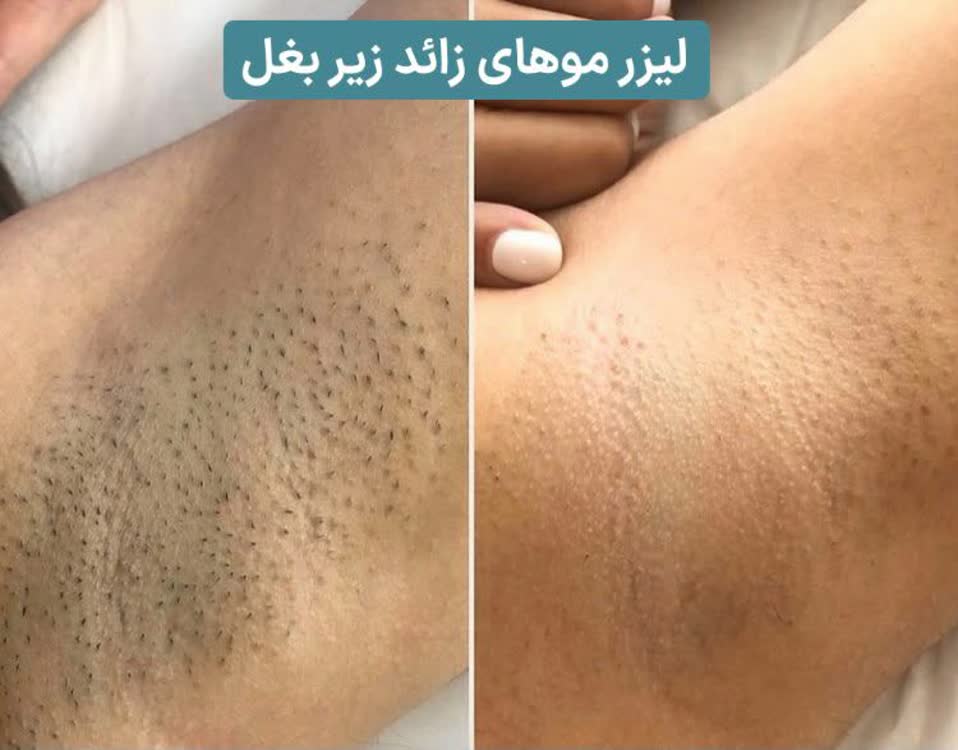 کلینیک زیبایی ،پوست و لیزر دکتر فهیمه عابدی منش سعادت اباد