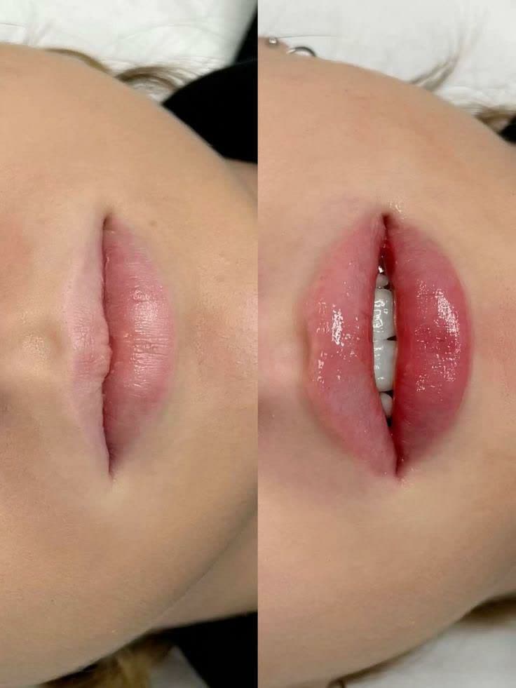 نمونه کارهای مركز زيبايي پرين