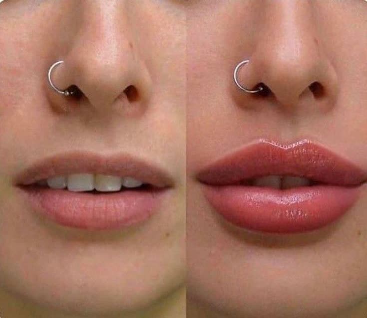 نمونه کارهای مركز زيبايي پرين