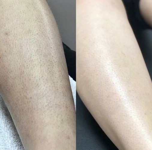 نمونه کارهای مركز زيبايي پرين